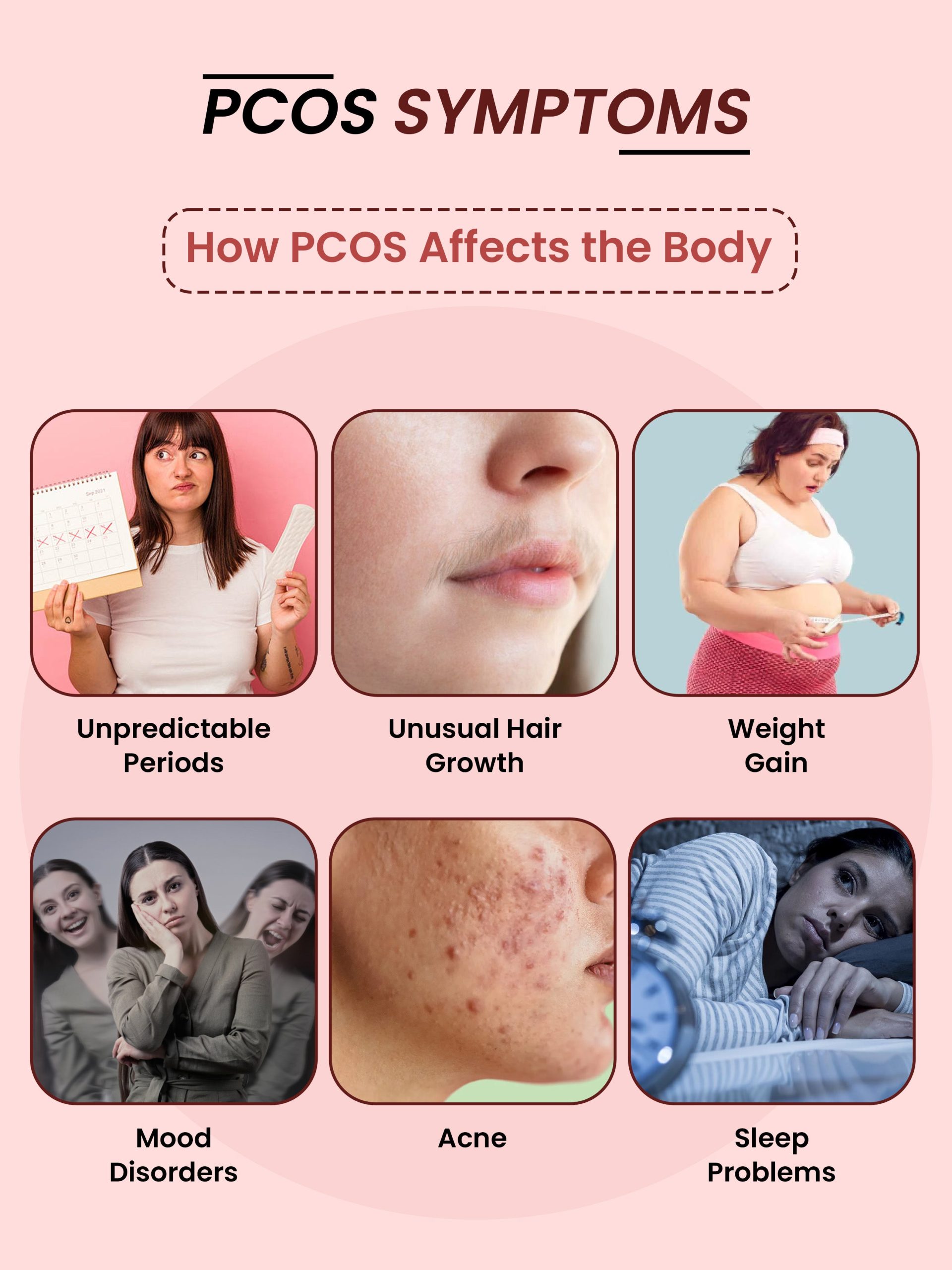 PCOS