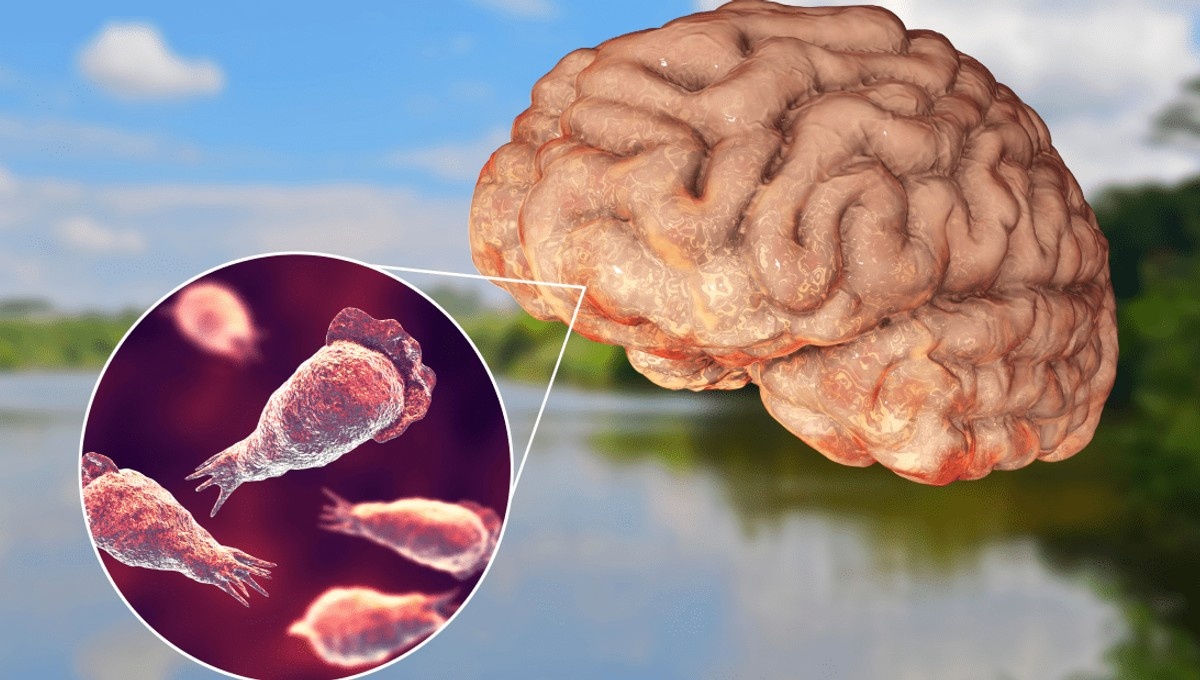 {ब्रेन-ईटिंग अमीबा)